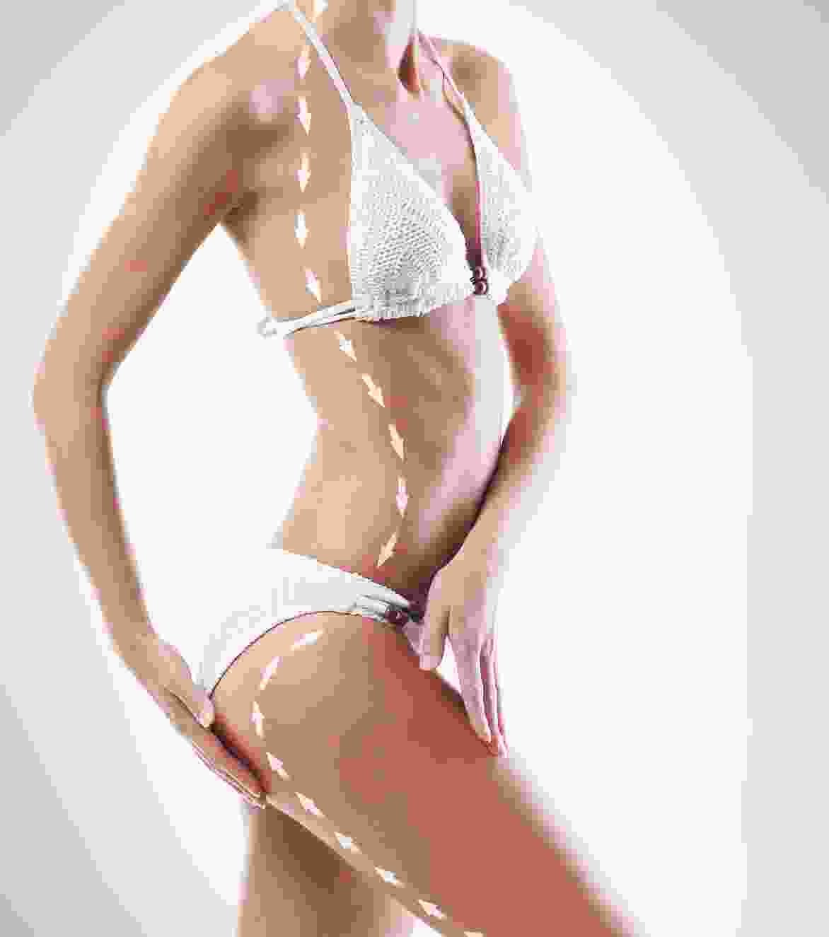 Botox treatment